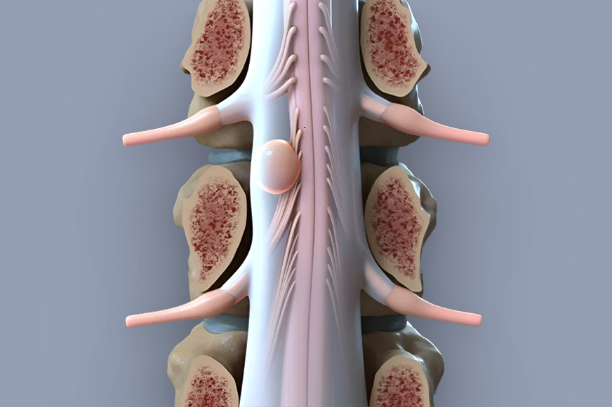 Bel Ağrısı Tedavisi, Boyun Ağrısı Tedavisi, Omurga Sağlığı, Skolyoz Tedavisi, Boyun Fıtığı Ameliyatı, Bel Fıtığı Tedavisi, Minimal Invaziv Cerrahi, Omurga Cerrahisi, Omurga Ameliyatı